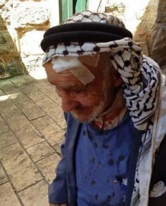 Раненный пожилой палестинец