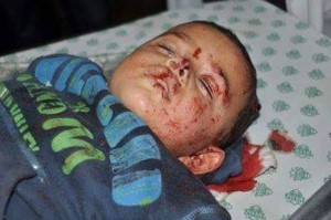 Шестилетний Ясин стал жертвой израильской атаки 