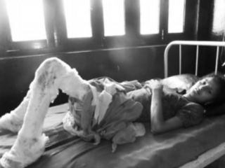 Муж сжег жену заживо, не получив в приданое мотоцикл