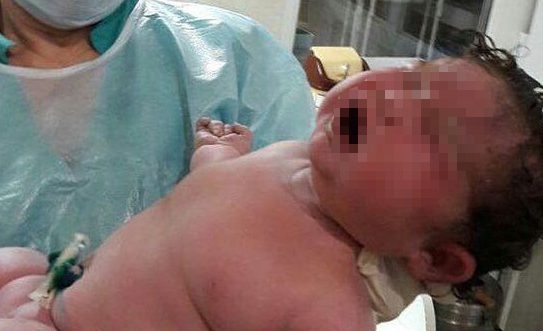 В Дагестане родился огромный ребенок