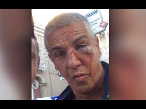 Изувеченному в центре Москвы Насери пришлось спасать глаз